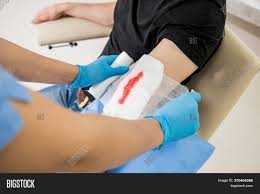 Nurse for wound Dressing